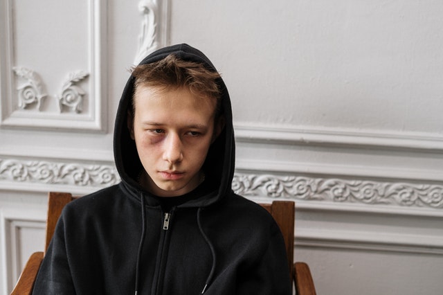 boy wearing black hoodie punched in the eye
